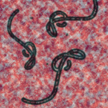 Ebola virüsü.