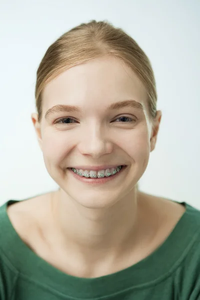 A menina sorridente com aparelho dentário . — Fotografia de Stock