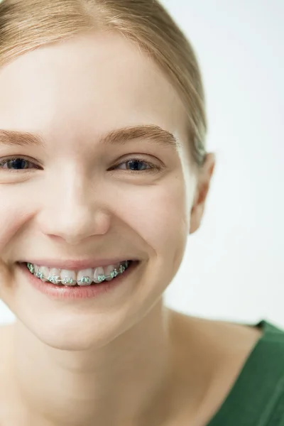 A menina sorridente com aparelho dentário . — Fotografia de Stock