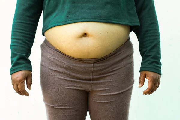 Close-up de mulher gorda no fundo branco. Conceito para a questão da obesidade, dieta de alimentos para a saúde . — Fotografia de Stock