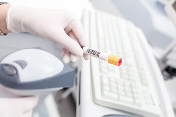 Hemşire tarafından beyaz Tıbbi Laboratuar tüpünde barkod tarama