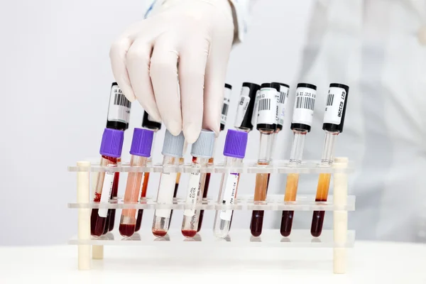 Test tüpleri kan ile stand