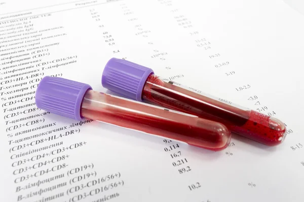 Red blood in test tubes on white blank — Stock Photo, Image