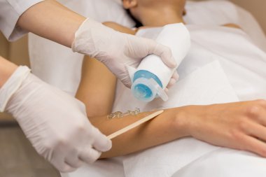 Cooling gel hair removal put on client hand