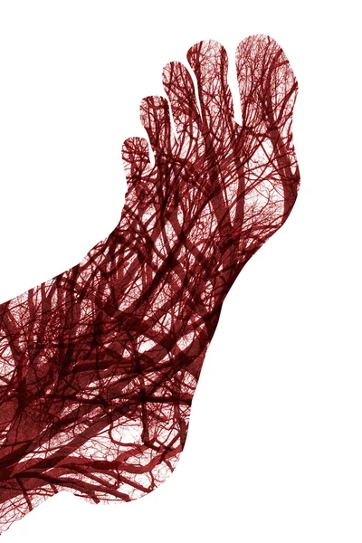 Vasos sanguíneos humanos — Foto de Stock