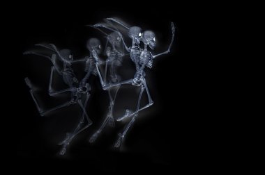 İskeletler X ışını dans