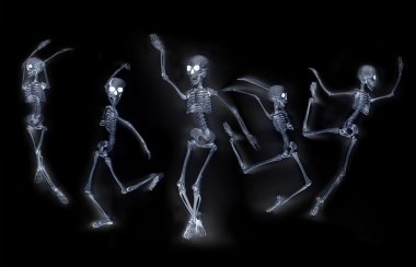 İskeletler X ışını dans