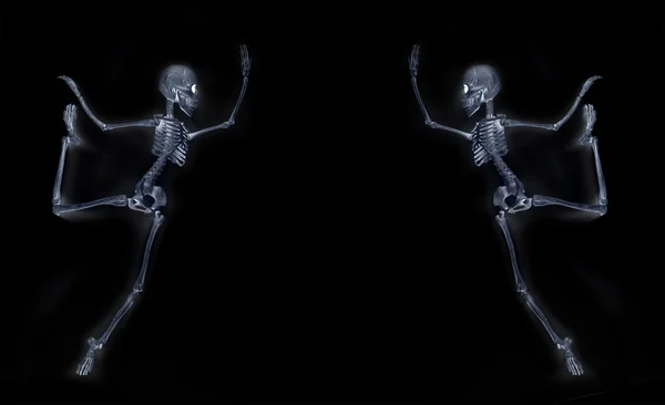 Tančící kostlivce X ray — Stock fotografie