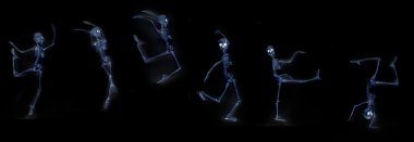 İskelet X-Ray dans