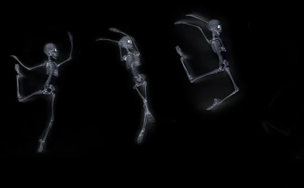 Dansende Skeleton X-Ray — Stockfoto