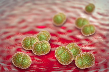 Meningitis Bacteria Infection clipart