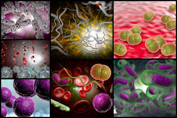 Colagem de infecção bacteriana — Fotografia de Stock