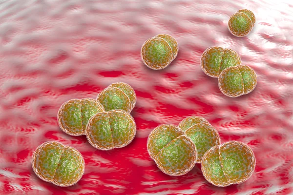 Meningitis bacteriën infectie — Stockfoto