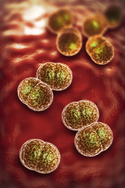 Infekce bakterií meningitida — Stock fotografie