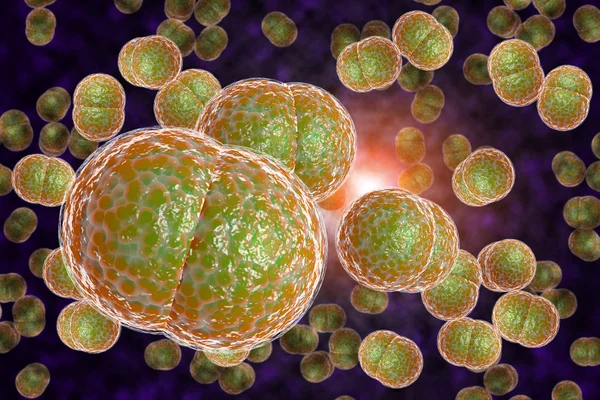 Meningitis Infección bacteriana — Foto de Stock