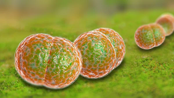 Meningite infecção bacteriana — Fotografia de Stock