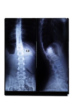X-ray Film clipart