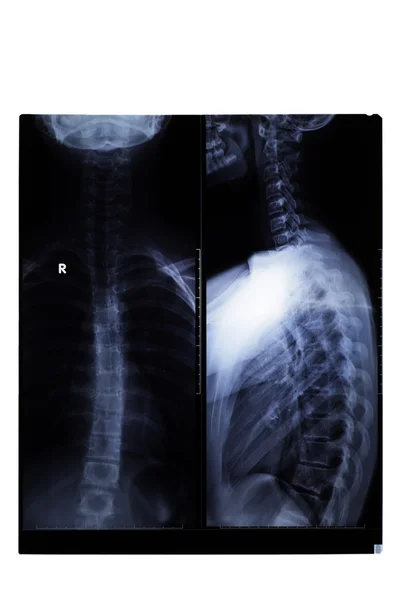 X-ray film — Stockfoto