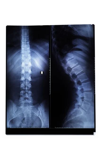 X-ray film Stock Obrázky