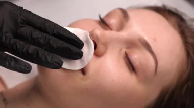 Dudak dolgu prosedüründen sonra kadının estetik açıdan yakın çekimi. Güzellik uzmanı güzellik kliniğinde dudaklarını süngerle yavaşça siler. Yumuşak cilt bakımı, temiz yüz, doğal gülümseme..