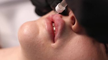 Dolma enjeksiyonu sırasında kadın dudaklarının makro yakın çekimi. Güzellik kliniğinde şırıngayla estetik kozmetik tedavisi, profesyonel cilt bakımı.