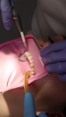 Şekil verip ayarladıktan sonra diş hekiminin durulama ve kurutma malzemelerini yakın plan çekimleri. Cilalamadan önce son temizlik, profesyonel diş tedavisi, hassas ağız bakımı.