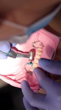 Diş macunlarını plastik diş cilasıyla cilalayan dişçilere yakın plan. Yenilenmiş dişlerin son düzleştirilmesi ve parlatılması. Profesyonel iyileştirici dişçilik prosedürü