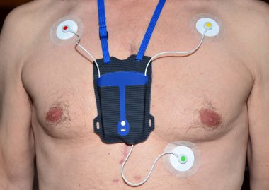 Holter kalp monitörü