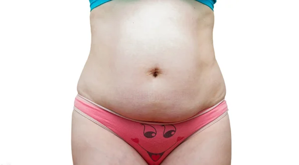 El cuerpo de una mujer gorda — Foto de Stock