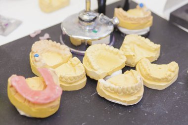 Teknisyenlerin çalışma masasında bir sürü diş protezi kalıbı var.