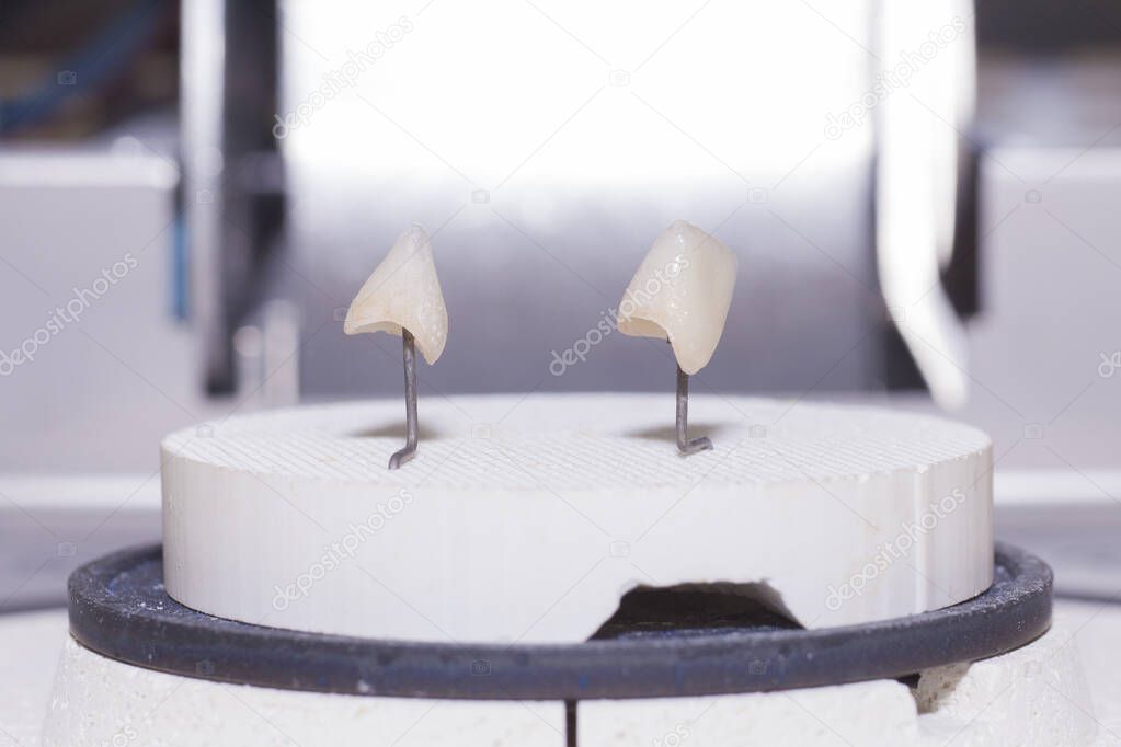 3d printed teeth being heated at machine