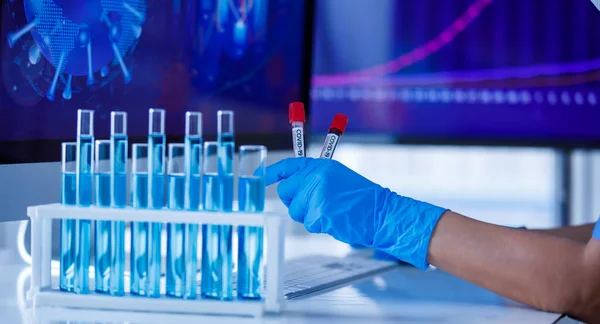Hand Wearing Blue Medical Gloves Holding Test Tube Typing Computer — Stock Photo, Image
