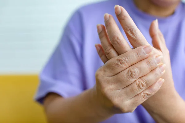 Avuçlarını tutmak için elini kullanan bir kadın acı, acı ve karıncalanma hisseder. Guillain barre sendromu kavramı ve uyuşmuş eller hastalığı.