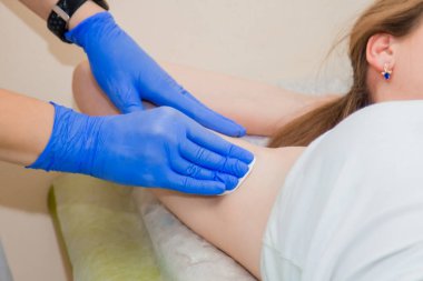 Mavi lastik eldivenli tüy dökücü ustasının elleri, bir müşterinin koltuk altını pamukla siliyor. Saç dökülmesi için hazırlık.