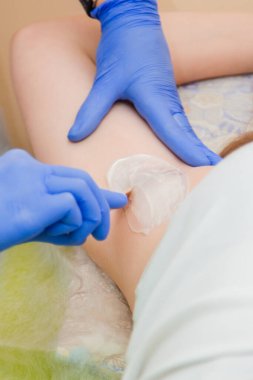 Mavi lastik eldivenli tüy dökücü ustasının yakın elleri müşterinin koltuk altına tahta bir spatulayla sıcak balmumu sürerler. Koltuk altı kıllarını çıkarma hazırlığı.