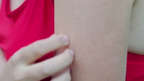 一只被鸡皮疙瘩覆盖的雌性手的特写 一个穿着红色游泳衣的湿湿的女人在寒冷中发抖 — 图库视频影像