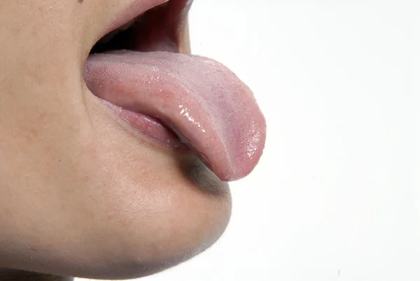 Хвора молода жінка показує язик — стокове фото