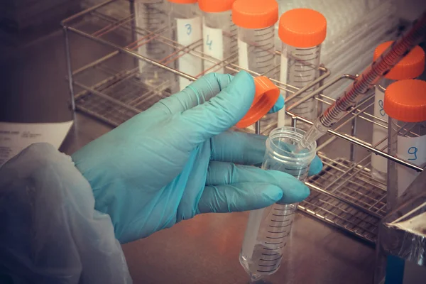 Lab technician takes sample from tube — Stock Photo, Image