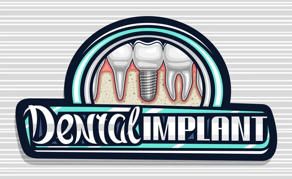 Vector Logo Dental Implant Clinic Dark Decorative Sign Board Illustration — Stock Vector