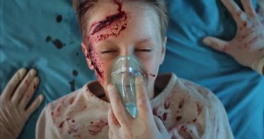 Sağlık görevlileri oksijen maskesini çıkardıktan sonra kafa travması geçiren küçük bir çocuğun gülümsemesi. Yüzünde kan olan çocuk hastaneye giderken ambulansta sedyede yatıyordu..