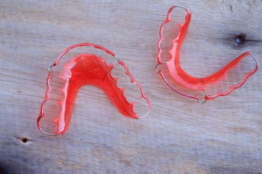 red retainer wire teeth clipart