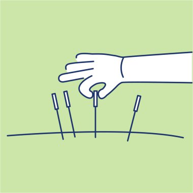 Acupuncture healing black linear icon