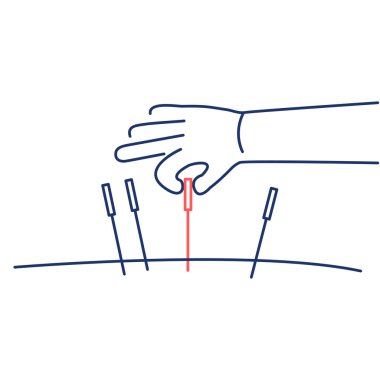 Acupuncture healing black linear icon