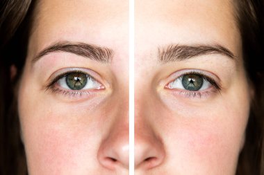 Kaşlarını koparıyor. Kaşlarını düzeltmeden önce ve sonra. Doğal boyasız kaşları ve gözleri olan genç bir kadın..