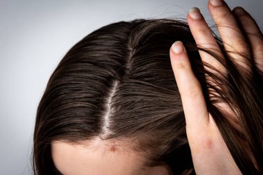 Gri arka planda kirli yağlı saçlı genç bir kadın..