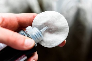 Hidrojen peroksit kullanarak cımbız temizleme.