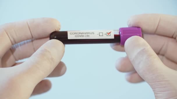 Tests Des Échantillons Covid Laboratoire — Video