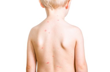 Su çiçeği ile çocuk