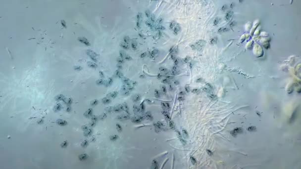 Animáció Mikroszkóp Alatti Vírusok Baktériumvírus — Stock videók
