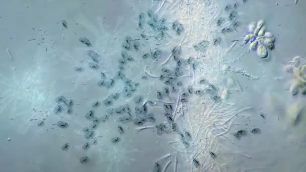 Animación Virus Bajo Microscopio Virus Las Bacterias — Vídeos de Stock